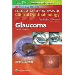 Glaucoma