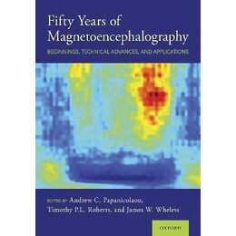Fifty Years of Magnetoencephalography : Beginnings, Technical Advances, and Applications