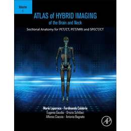 Atlas of Hybrid Imaging Sectional Anatomy for Pet/ct, Pet/mri and Spect/ct Vol. 1: Brain and Neck