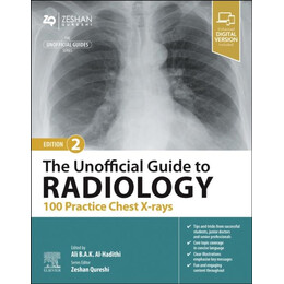 Unofficial Guide to Radiology: 100 Practice Chest x-Rays