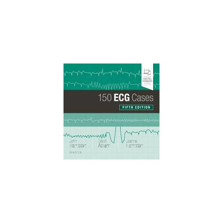 150 ecg Cases 5th Edition