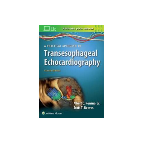 A Practical Approach to Transesophageal Echocardiography