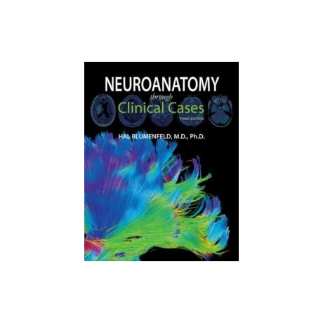 Neuroanatomy Through Clinical Cases