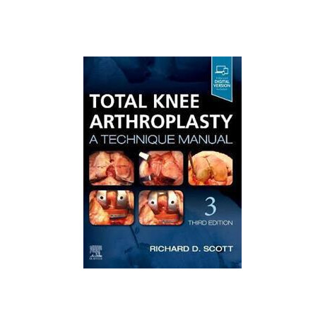 Total Knee Arthroplasty : a Technique Manual