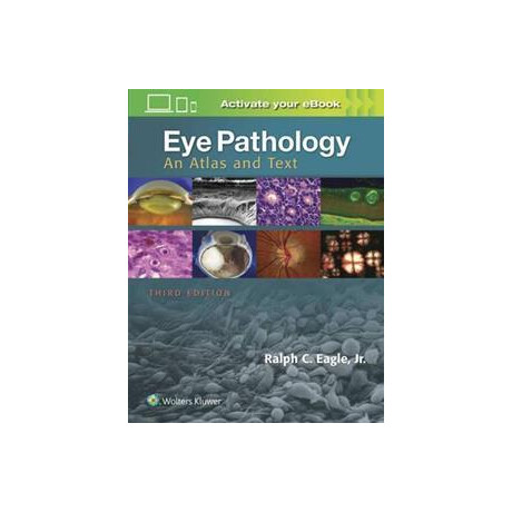 Eye Pathology : an Atlas and Text