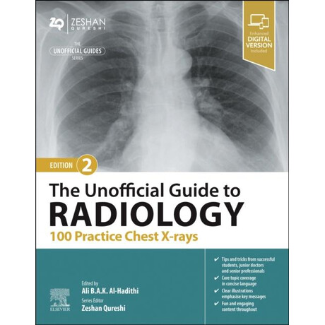 Unofficial Guide to Radiology: 100 Practice Chest x-Rays