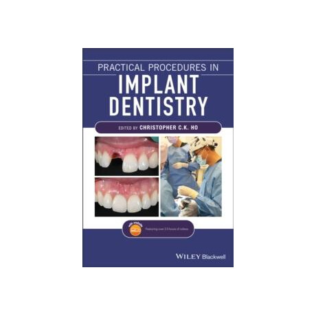 Practical Procedures in Implant Dentistry
