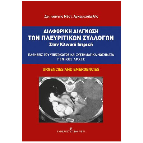 Διαφορική Διάγνωση των Πλευριτικών Συλλογών Στην Κλινική Ιατρική
